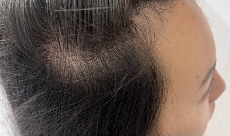 Клиент до лечения